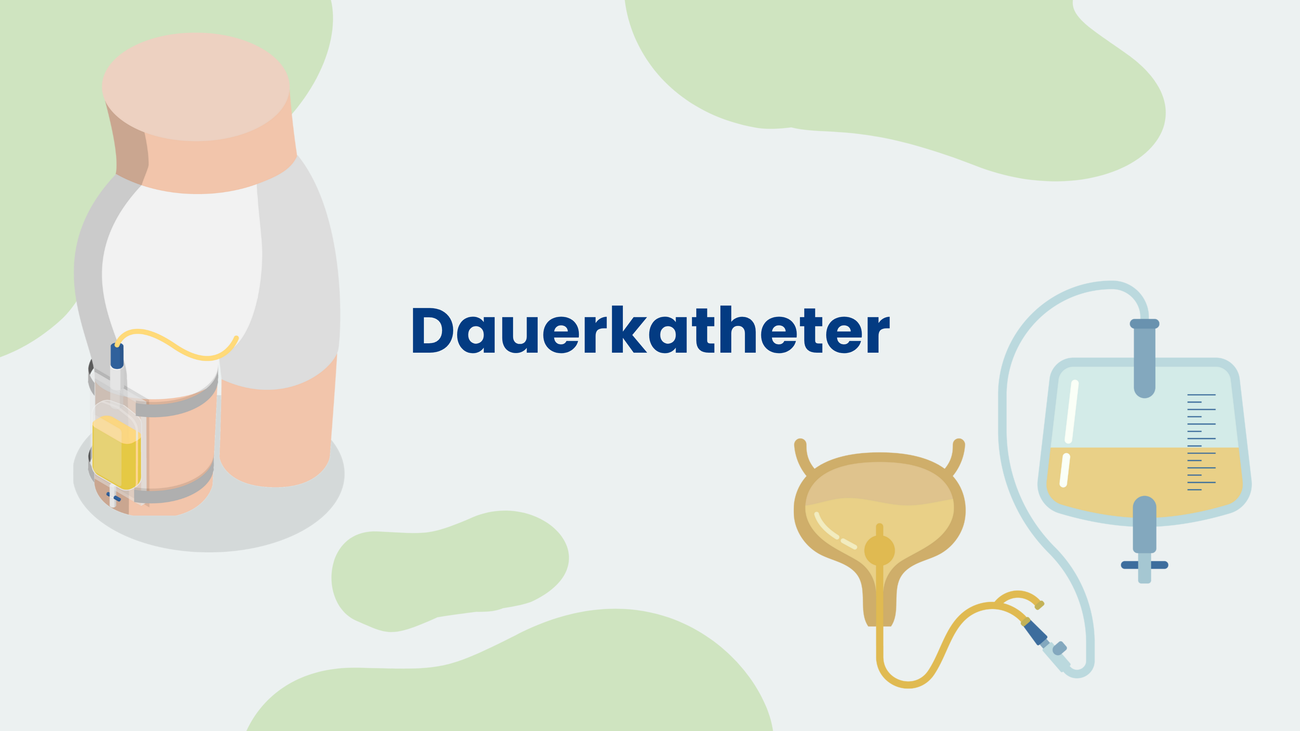 Grafik mit der Überschrift ‚Dauerkatheter‘; links Oberschenkel mit fixiertem Beinbeutel und Schlauch, rechts stilisierte Harnblase mit Schlauch zu einem Urinbeutel mit Messskala.